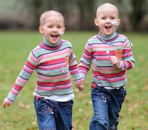 Si un jumeau a un cancer, le risque est accru pour l'autre